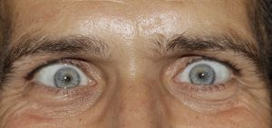 eyes-421781-300x142.jpg